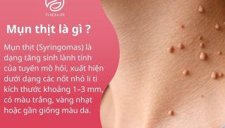 Mụn thịt: Nguyên nhân hình thành và cách loại bỏ an toàn, không sẹo