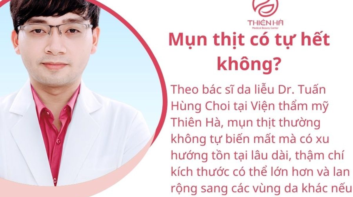 Mụn thịt có tự hết không? Tư vấn chuyên gia Viện thẩm mỹ Thiên Hà