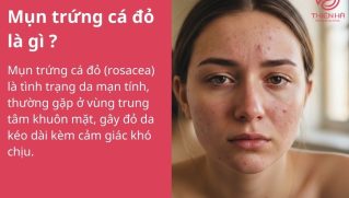 Mụn trứng cá đỏ: Nguyên nhân, dấu hiệu và cách kiểm soát an toàn