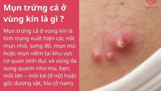 Mụn trứng cá ở vùng kín: Nguyên nhân và cách điều trị an toàn