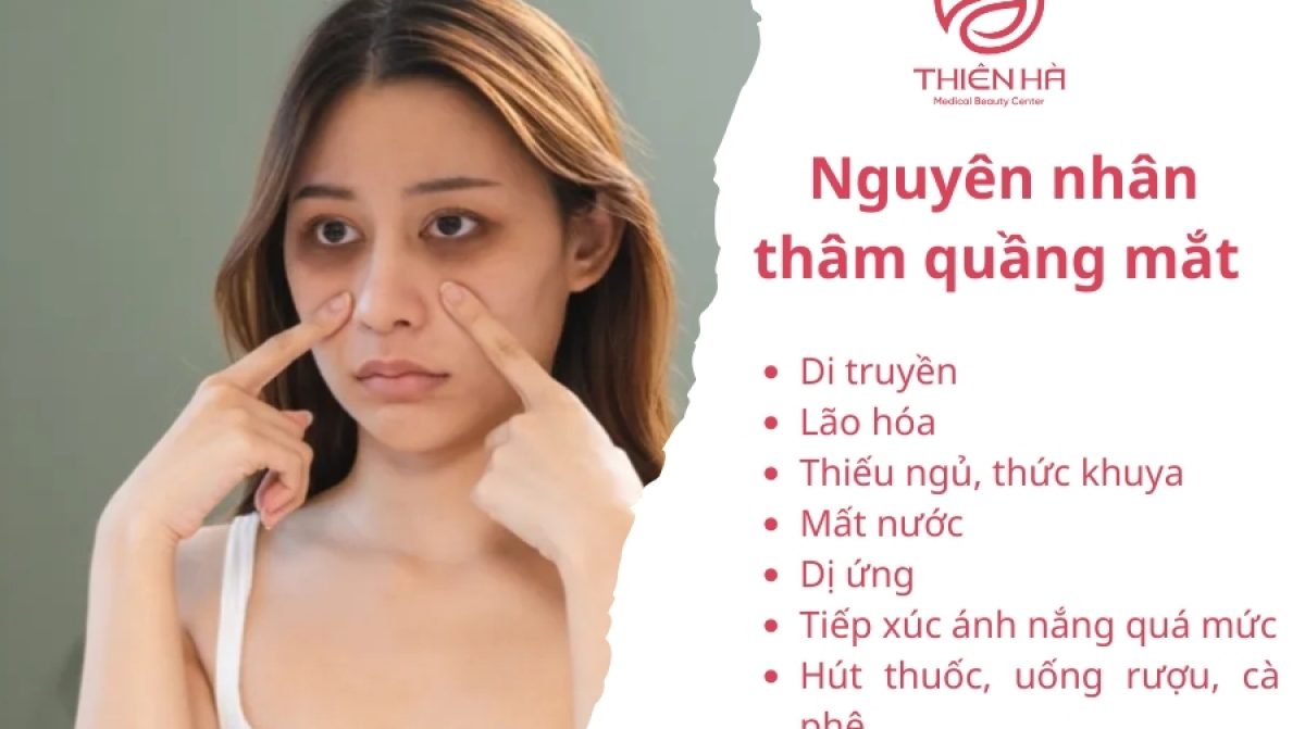 Ngủ sớm có hết thâm mắt không? Sự thật bất ngờ!