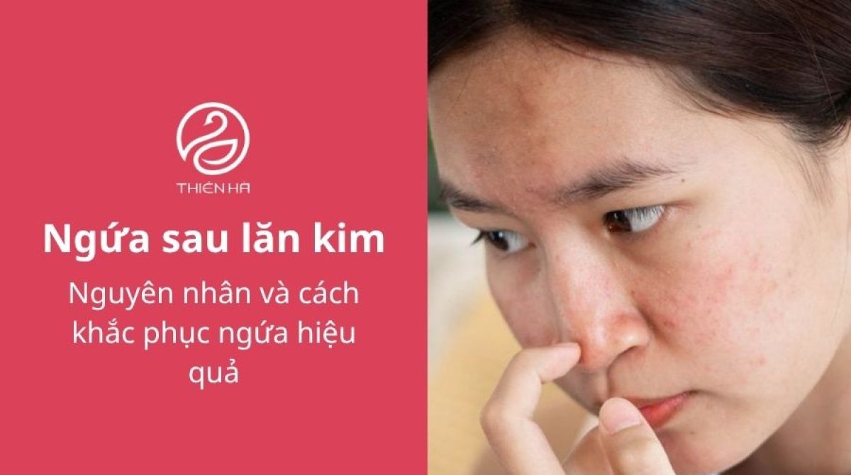 Ngứa sau lăn kim: Nguyên nhân và cách khắc phục hiệu quả