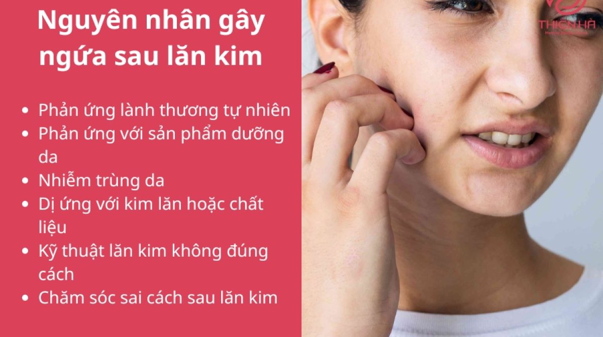 Ngứa sau lăn kim: Nguyên nhân và cách khắc phục hiệu quả