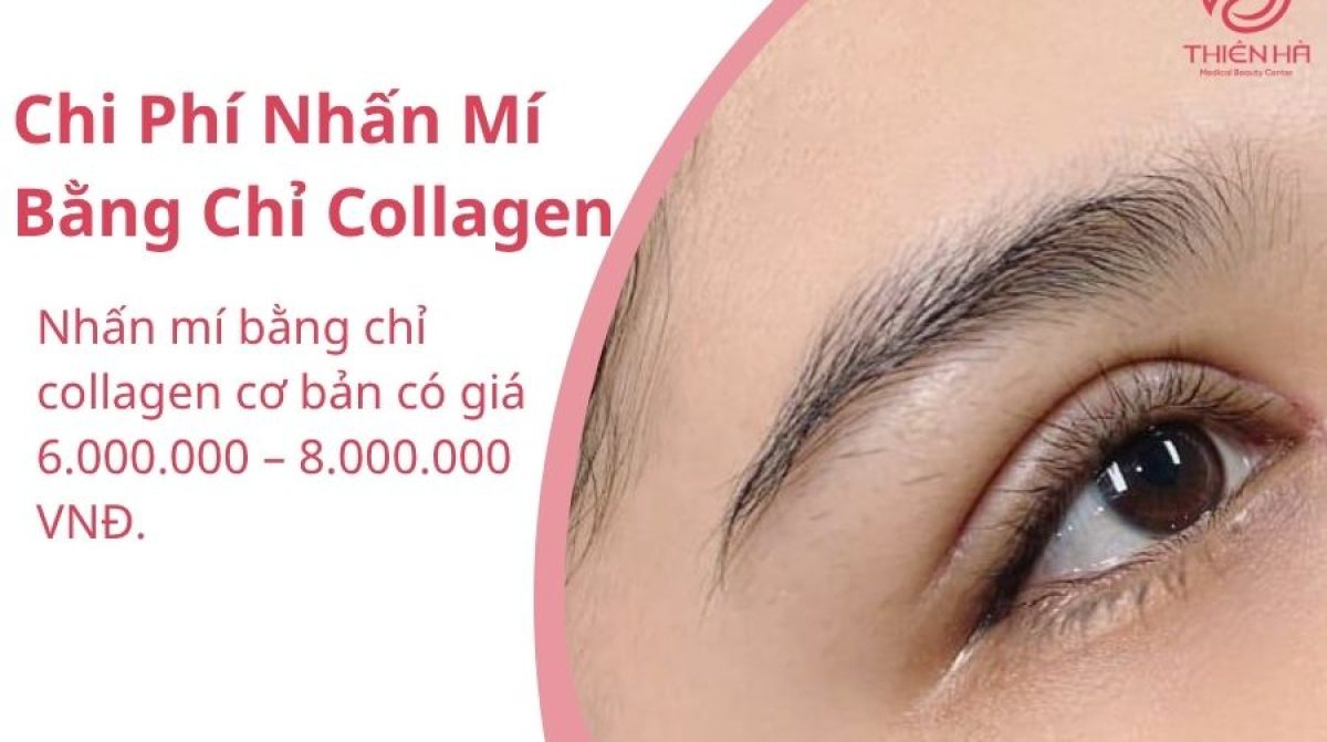 Nhấn Mí Bằng Chỉ Vi Sợi Collagen: Lợi Ích, Quy Trình & Chi Phí | TMV Thiên Hà