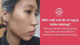 Nốt ruồi mờ đi: Có nguy hiểm không và khi nào cần kiểm tra?