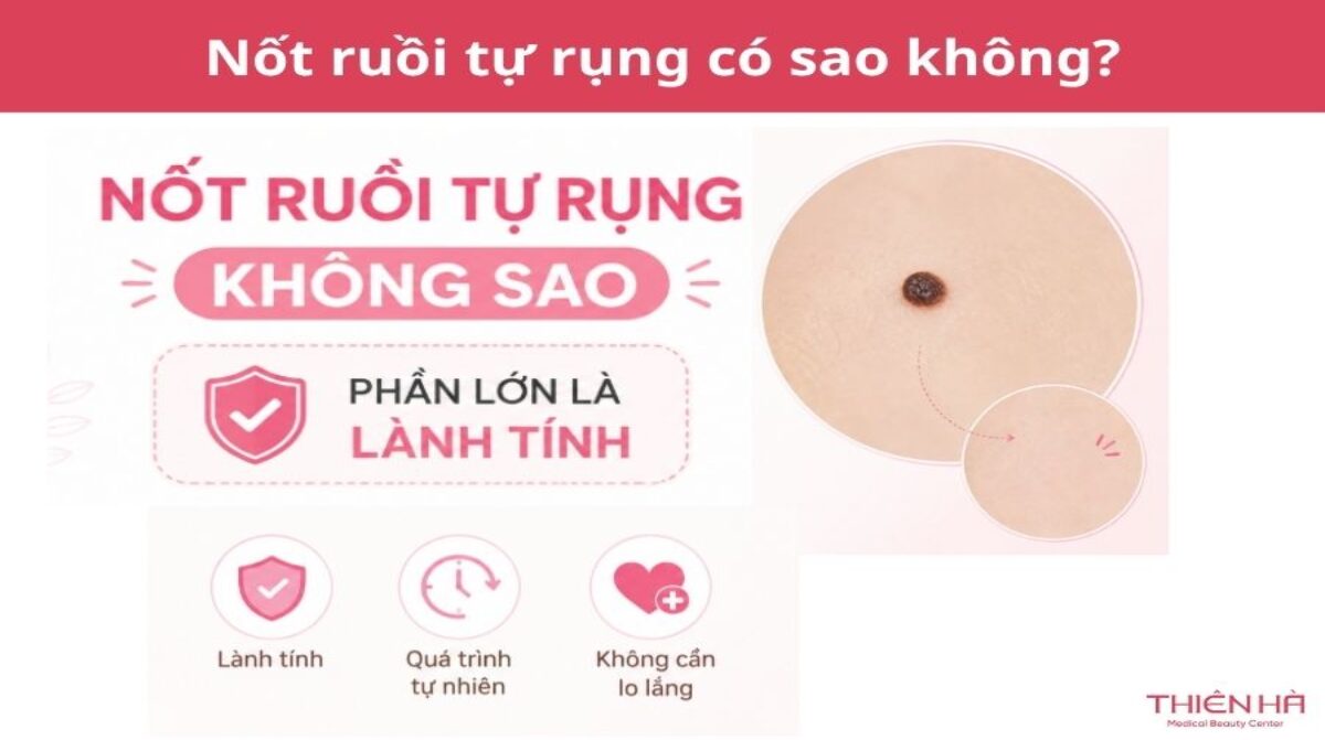 Nốt ruồi tự rụng có sao không? Cách nhận biết và xử lý an toàn