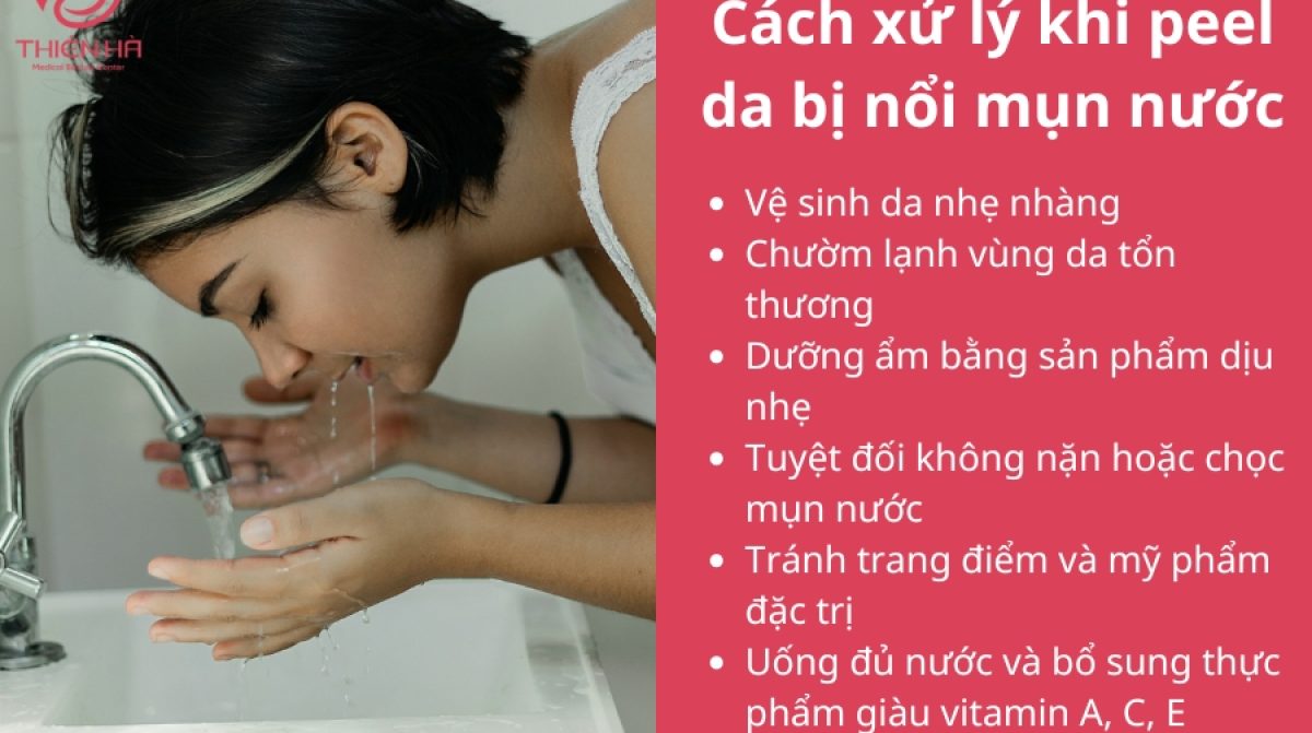 Peel da bị nổi mụn nước: Nguyên nhân, cách xử lý, phòng ngừa
