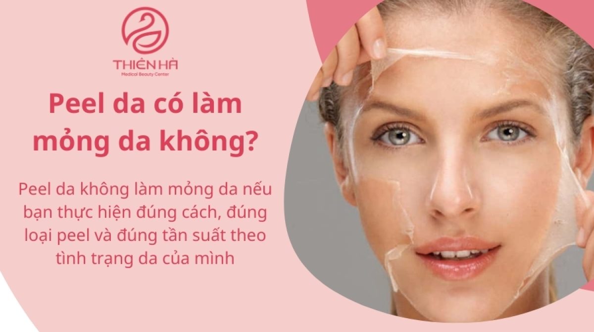 Peel da có làm mỏng da không? Lời giải đáp từ chuyên gia