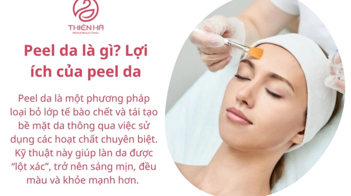 Peel da giá bao nhiêu? Bảng giá peel da mới nhất