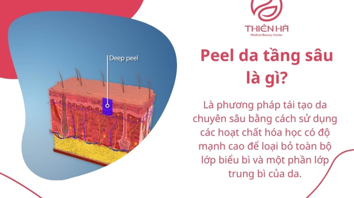 Peel da tầng sâu: Lợi ích, quy trình & những điều cần lưu ý