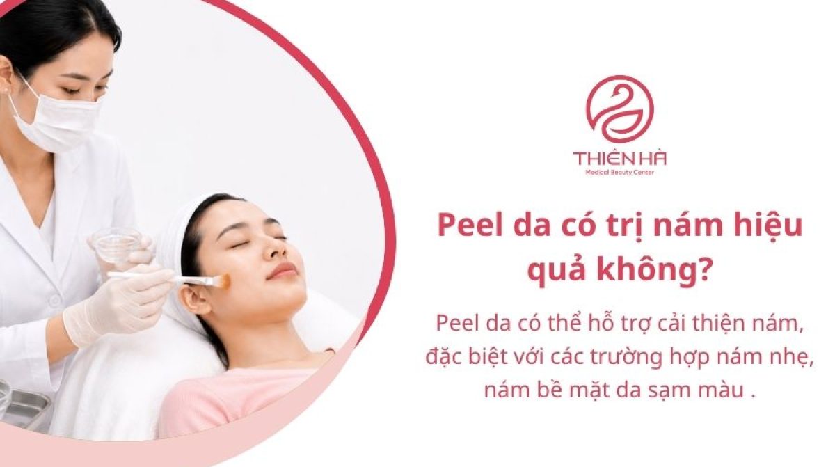 Peel da trị nám là gì? Tất cả thông tin về hiệu quả, giá cả