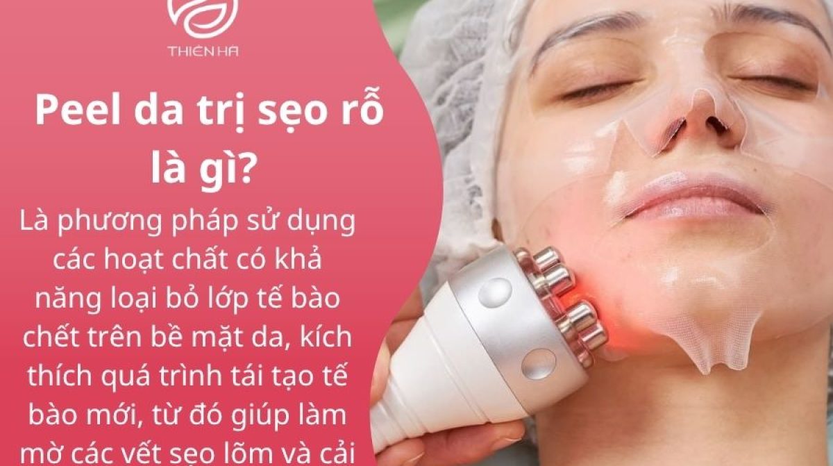 Peel da trị sẹo rỗ: Hiệu quả, quy trình và lưu ý quan trọng | Viện thẩm mỹ Thiên Hà