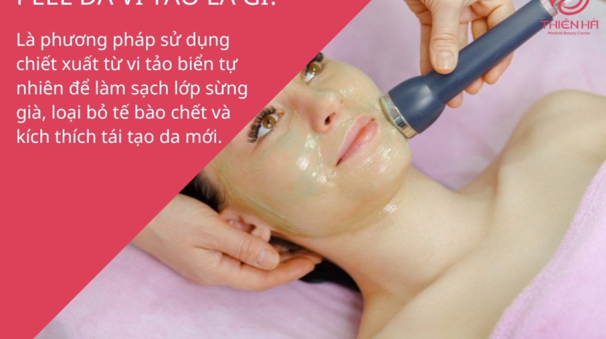 Peel da vi tảo: Lợi ích, quy trình & lưu ý quan trọng