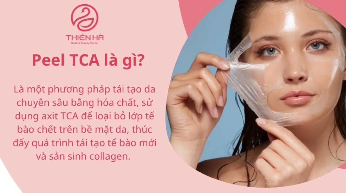 Peel TCA là gì? Tác dụng, quy trình và giá peel da TCA