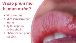 Phun môi bị mụn nước: Nguyên nhân, dấu hiệu và cách xử lý an toàn