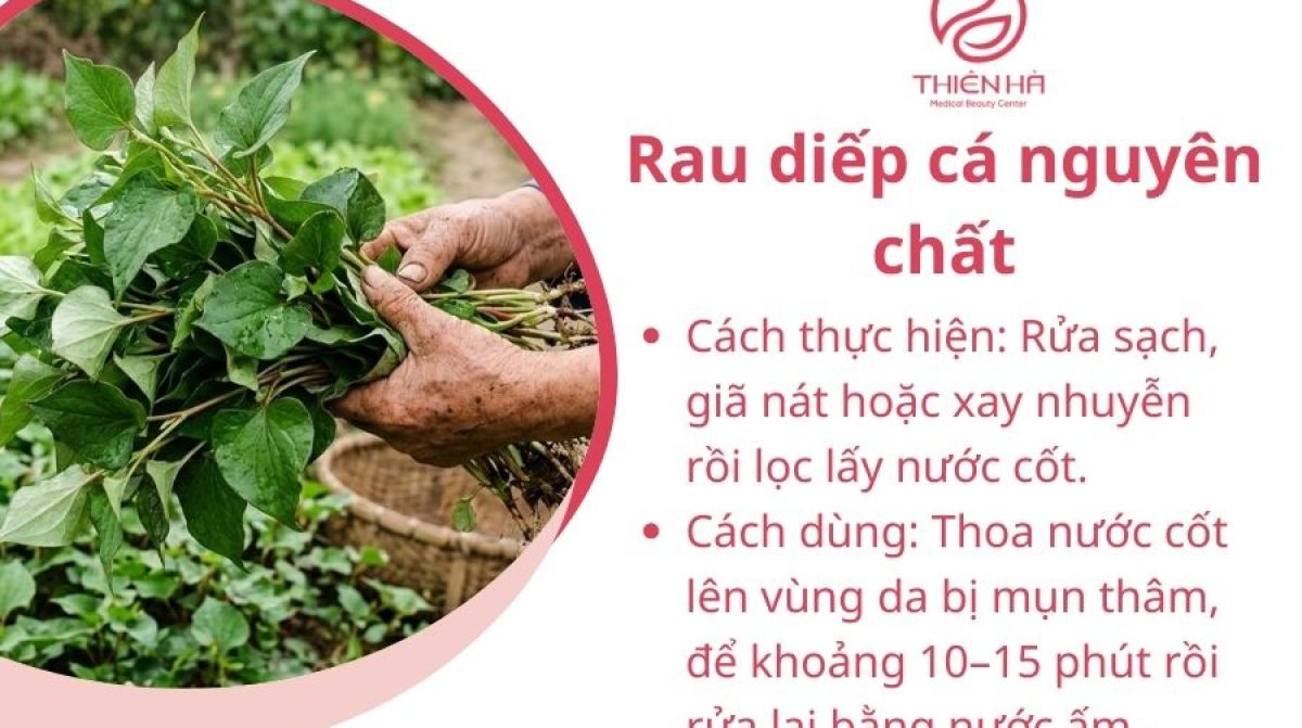 Cách dùng rau diếp cá trị mụn thâm hiệu quả, tránh kích ứng da