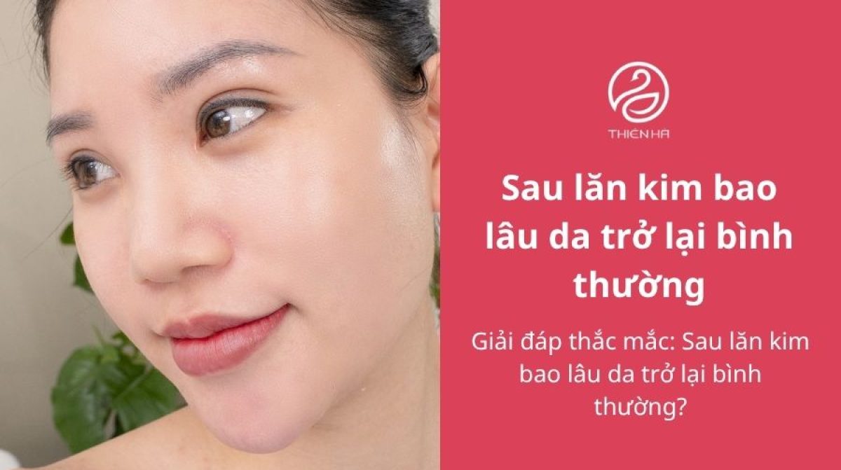 Giải đáp thắc mắc: Sau lăn kim bao lâu da trở lại bình thường?