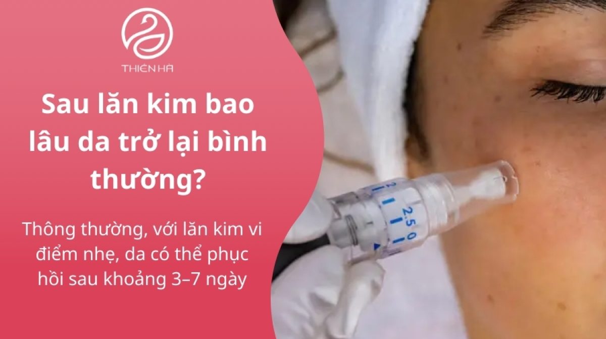 Giải đáp: Sau lăn kim bao lâu da trở lại bình thường?