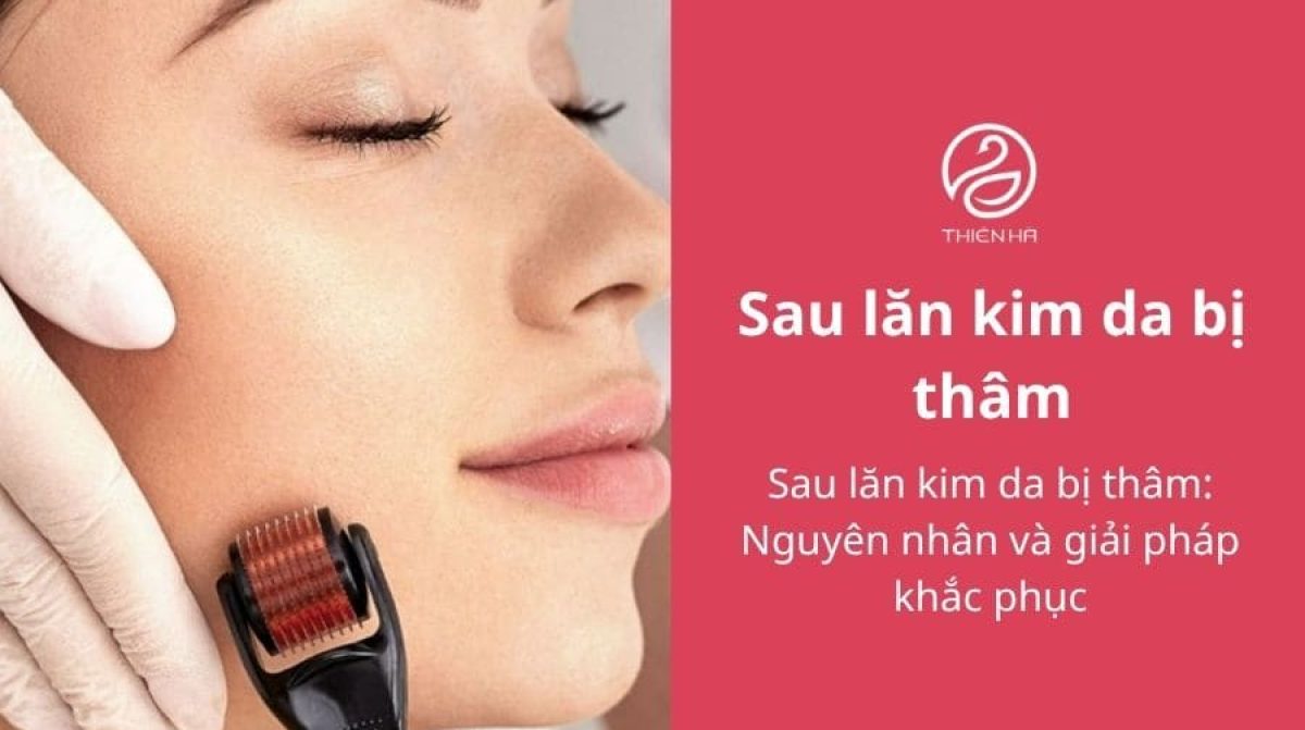 Sau lăn kim da bị thâm: Nguyên nhân và giải pháp khắc phục