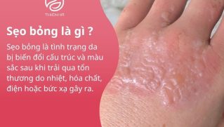 Điều trị sẹo bỏng hiệu quả: từ sơ cứu ban đầu đến công nghệ y khoa
