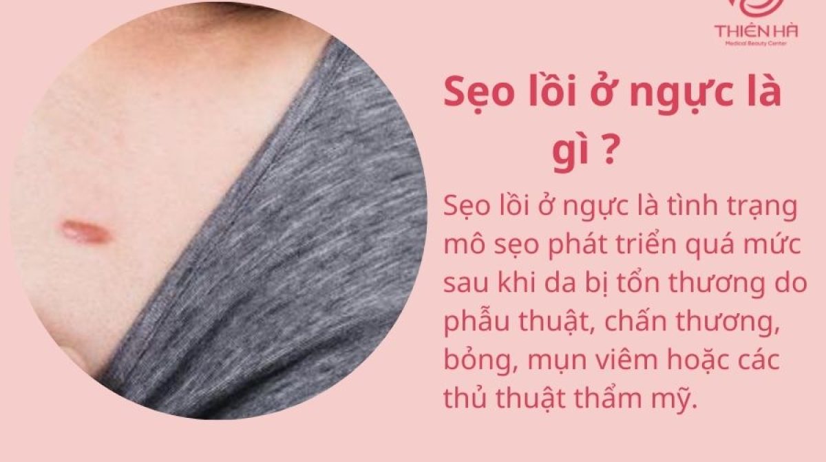 Sẹo lồi ở ngực: Nguyên nhân và cách trị dứt điểm hiệu quả