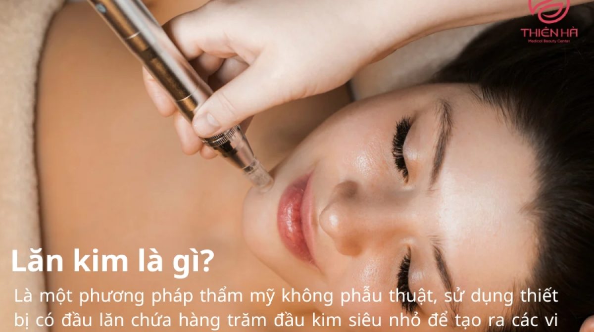 Tác hại của lăn kim: Những điều bạn cần biết trước khi thực hiện