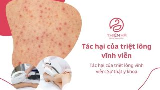 Tác hại của triệt lông vĩnh viễn: Sự thật y khoa