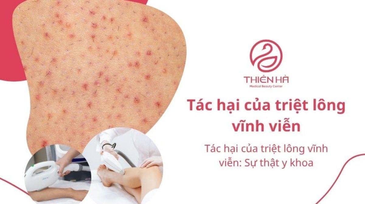 Tác hại của triệt lông vĩnh viễn: Sự thật y khoa
