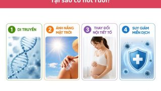 Tại sao lại có nốt ruồi? Nguyên nhân và cách nhận biết