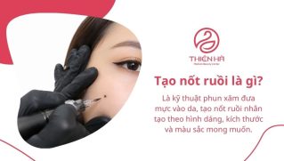 Tạo nốt ruồi đẹp tự nhiên: Phương pháp, độ bền và chi phí