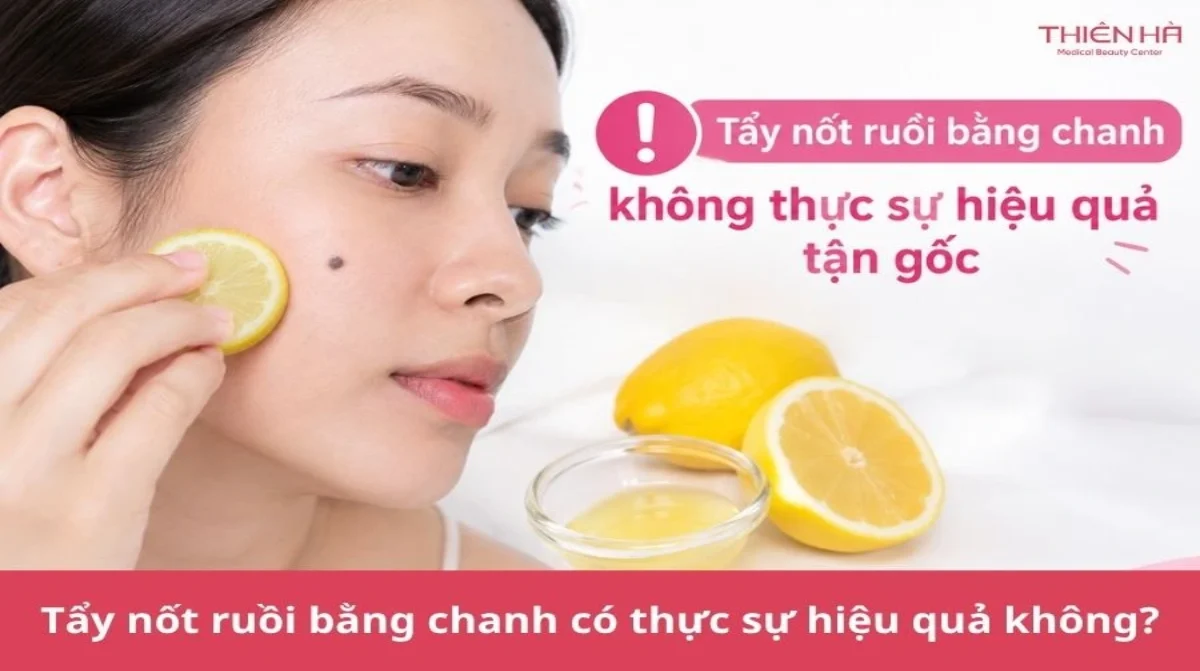 Tẩy nốt ruồi bằng chanh: 3 cách thực hiện và lưu ý an toàn
