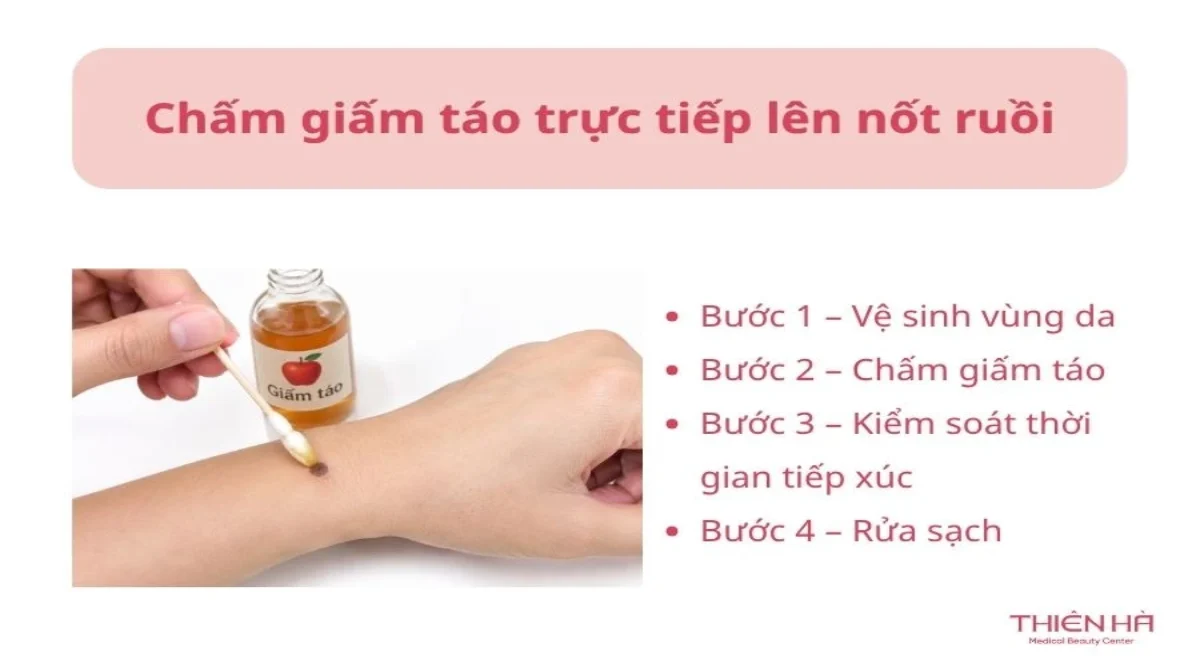 Tẩy nốt ruồi bằng giấm táo: Cách thực hiện và rủi ro