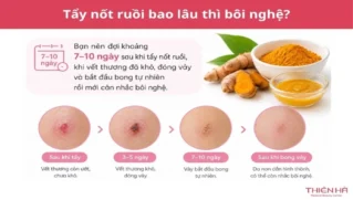 Tẩy nốt ruồi bao lâu thì bôi nghệ? Thời điểm và cách bôi