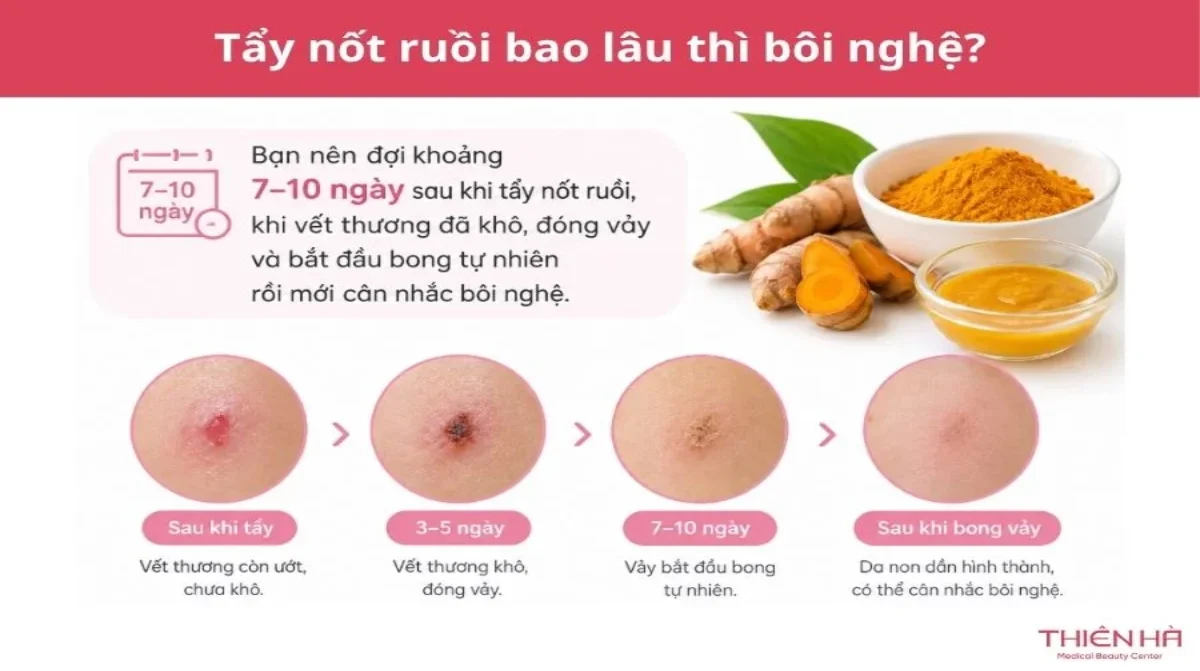 Tẩy nốt ruồi bao lâu thì bôi nghệ? Thời điểm và cách bôi