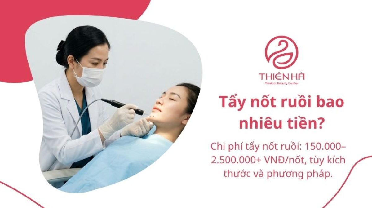 Tẩy nốt ruồi bao nhiêu tiền? Bảng giá chi tiết và lưu ý cần biết