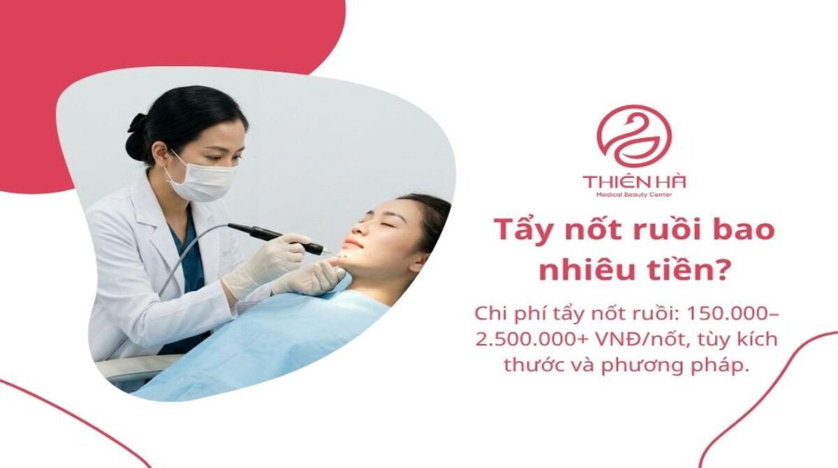 Tẩy nốt ruồi bao nhiêu tiền? Bảng giá chi tiết và lưu ý cần biết