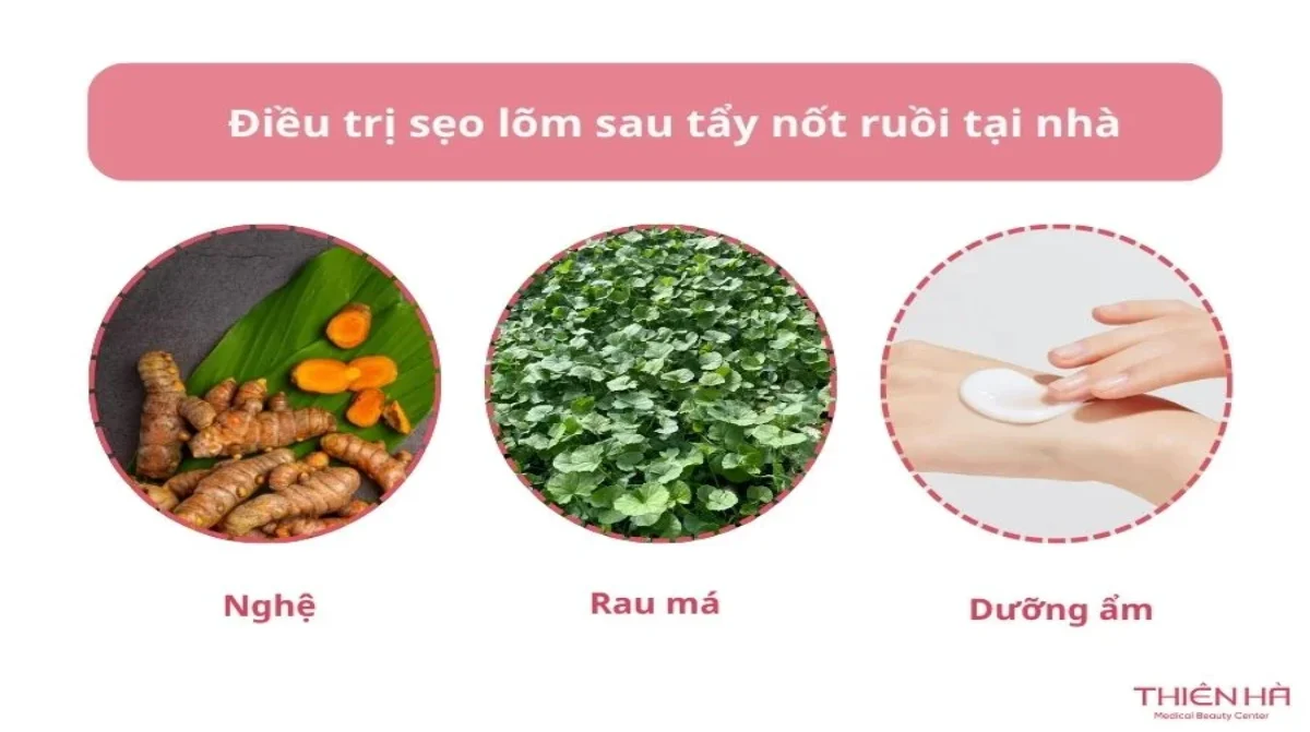 Tẩy nốt ruồi bị sẹo lõm phải làm sao? Cách khắc phục an toàn