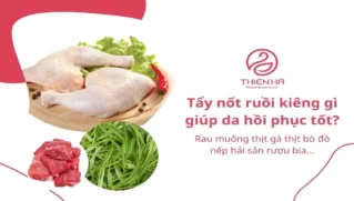 Tẩy nốt ruồi kiêng gì? Thời gian kiêng và cách chăm sóc da