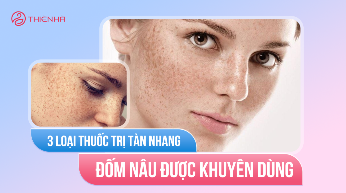 Top 3 loại thuốc trị tàn nhang đốm nâu được khuyên dùng