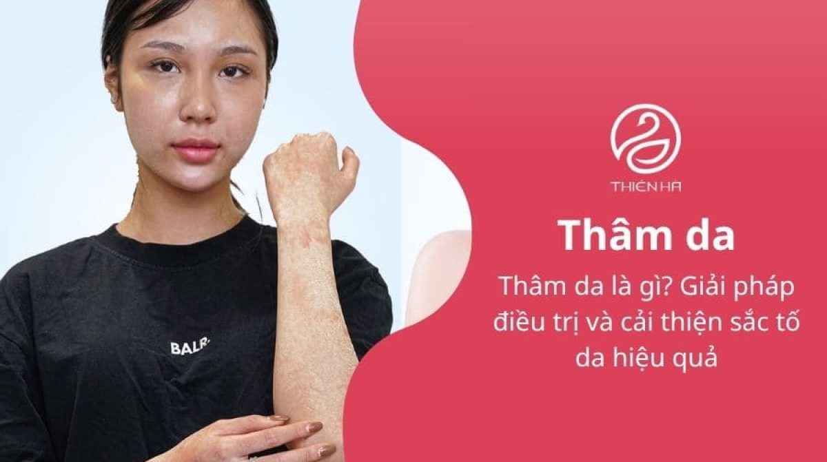 Thâm da là gì? Giải pháp điều trị và cải thiện sắc tố da hiệu quả
