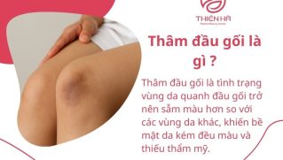 Thâm đầu gối là gì ? Nguyên nhân và cách khắc phục hiệu quả tại nhà