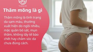 Thâm mông là gì ? Nguyên nhân và cách làm sáng da mông hiệu quả tự nhiên