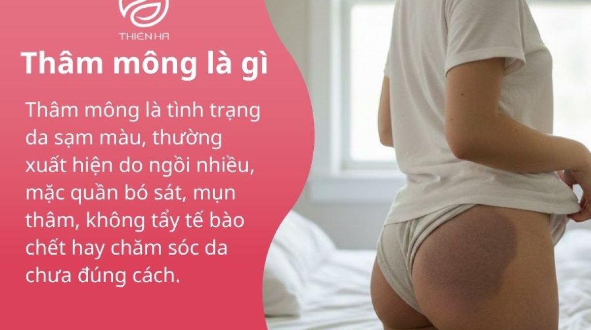 Thâm mông là gì ? Nguyên nhân và cách làm sáng da mông hiệu quả tự nhiên