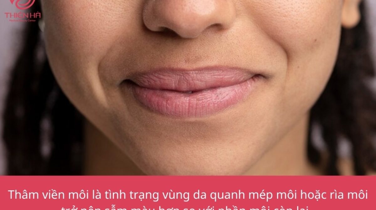 Thâm viền môi: Từ nguyên nhân đến giải pháp