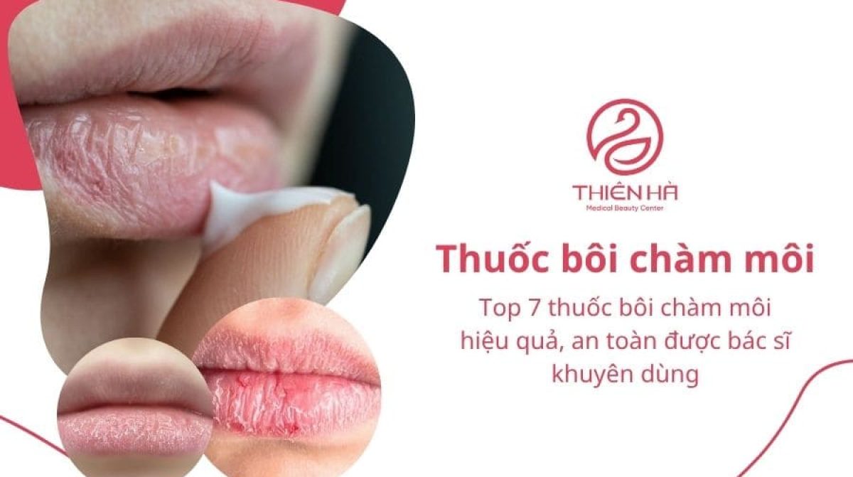 Top 7 thuốc bôi chàm môi hiệu quả, an toàn được bác sĩ khuyên dùng