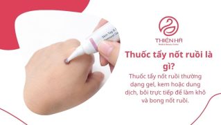 Thuốc tẩy nốt ruồi: Các loại phổ biến và lưu ý an toàn