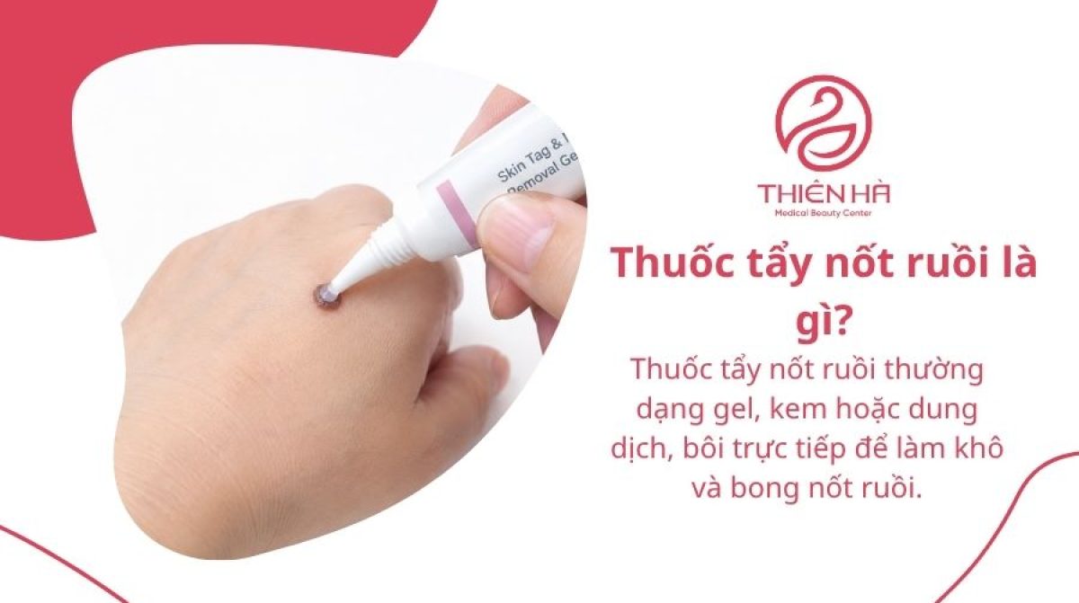Thuốc tẩy nốt ruồi: Các loại phổ biến và lưu ý an toàn