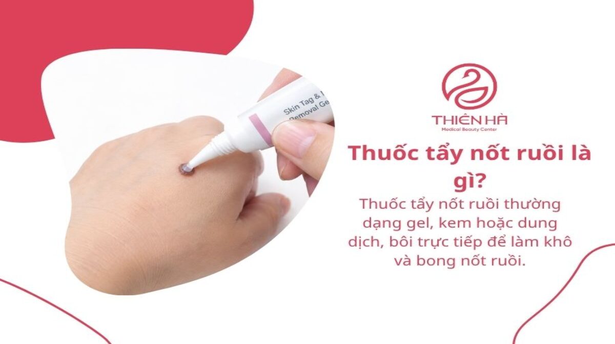 Thuốc tẩy nốt ruồi: Các loại phổ biến và lưu ý an toàn