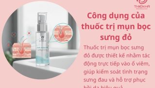 Top 5 thuốc trị mụn bọc sưng đỏ được tin dùng và an toàn cho da