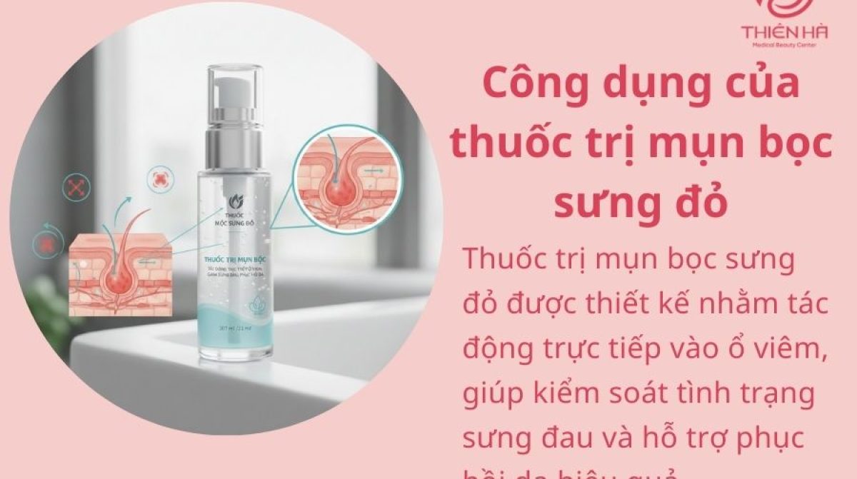 Top 5 thuốc trị mụn bọc sưng đỏ được tin dùng và an toàn cho da